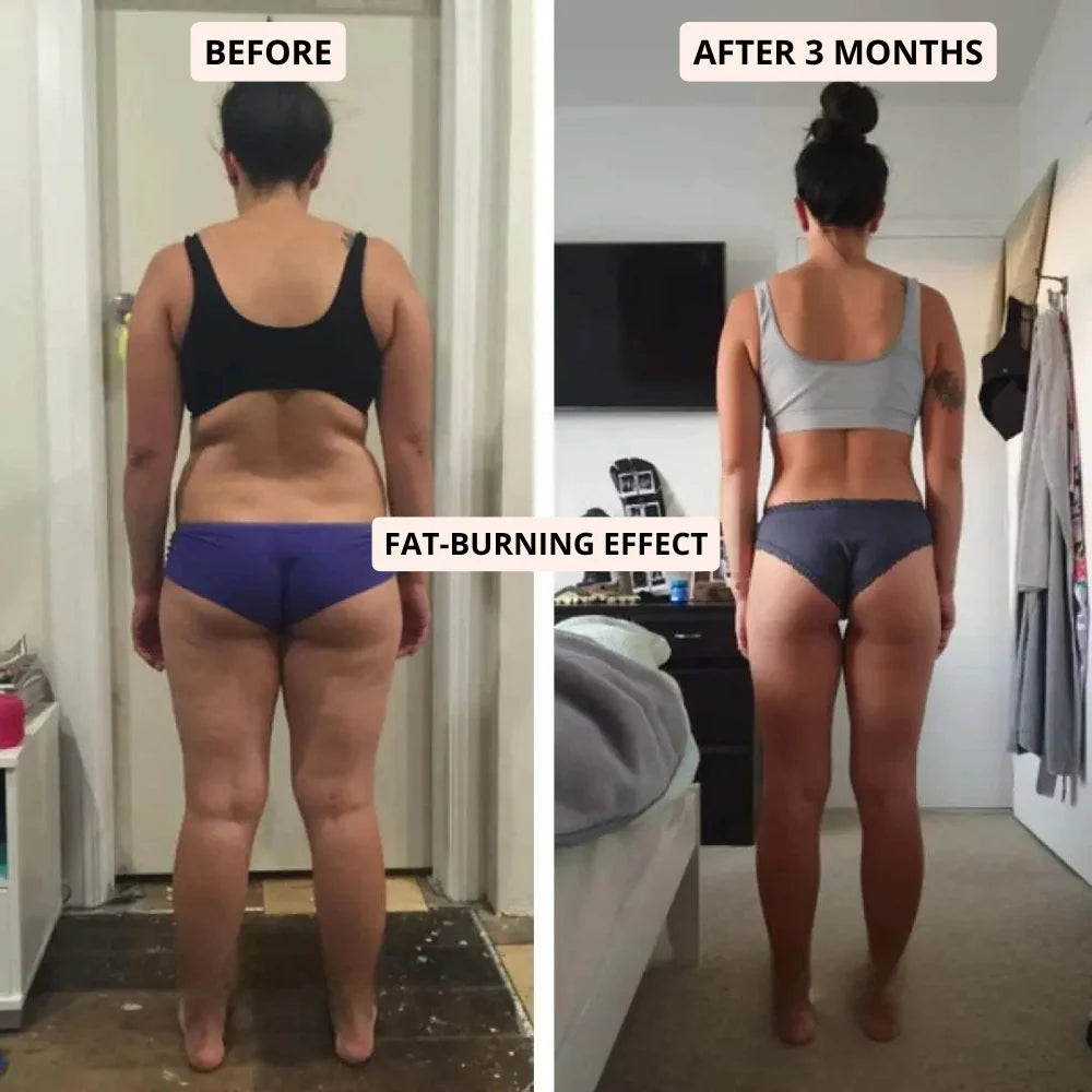 Fitlegs 3D Anti-Cellulite Leggings